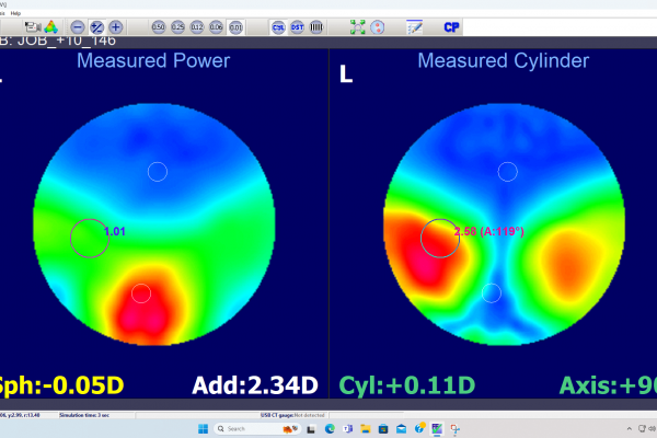 Near optic zone issue