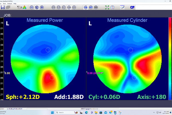 Near optic zone issue